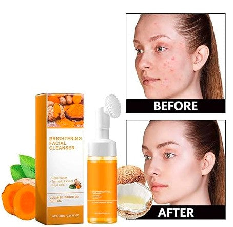 Turmeric ππ¨π£π’π Face Wash, Natural (Pack of - 1 ) 150 ML